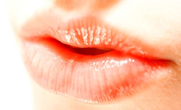 Labios secos y deshidratados