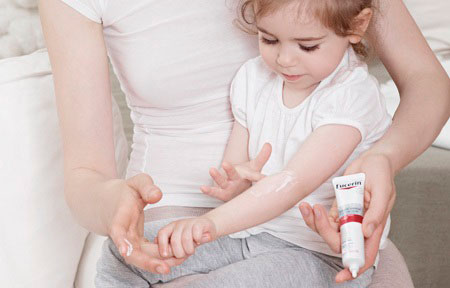 Niños y dermatitis atópica: ¿cómo tratarla?