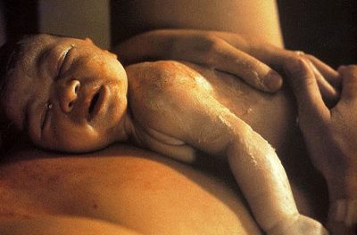 El bebé viene de nalgas, ¿significa un parto con cesárea?