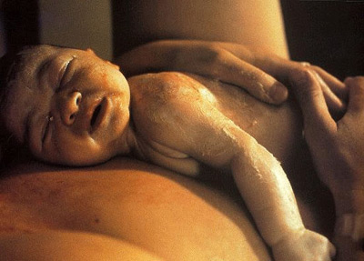 El bebé viene de nalgas, ¿significa un parto con cesárea?