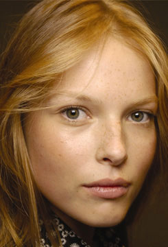 Las pecas