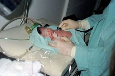 Problemas médicos en el recién nacido: Dilatación de pelvis renal