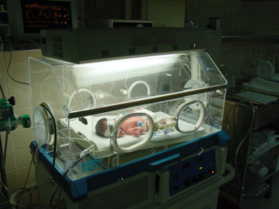 Problemas médicos en el recién nacido: Ictericia