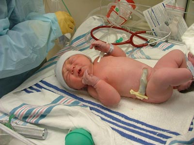 Problemas médicos en el recién nacido: sospecha de infección