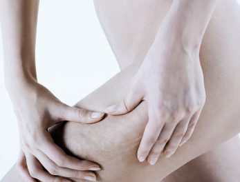 Tipos de celulitis, consejos y tratamientos