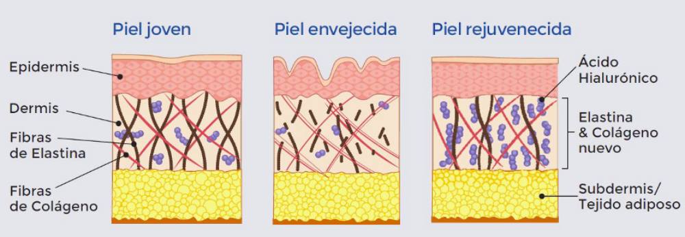 Complemento alimenticio