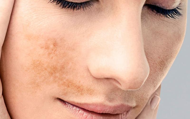 Las mandarinas japonesas son buenas para prevenir las manchas del sol